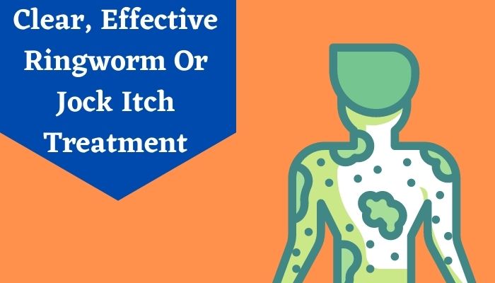 Effective Home Remedies For Jock Itch Jock Itch Treatment