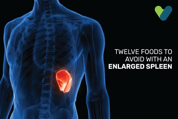 Splenomegaly Diet : 12 Foods To Avoid With Enlarged Spleen