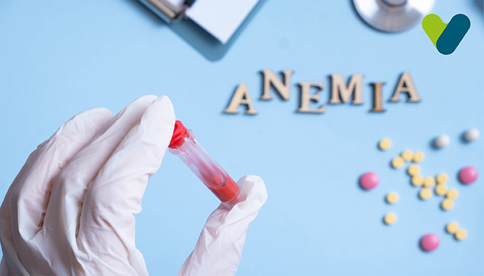 Top 8 Treatments Of Anemia for Instant Relief