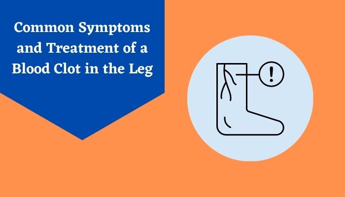 Common Symptoms and Treatment of a Blood Clot in the Leg