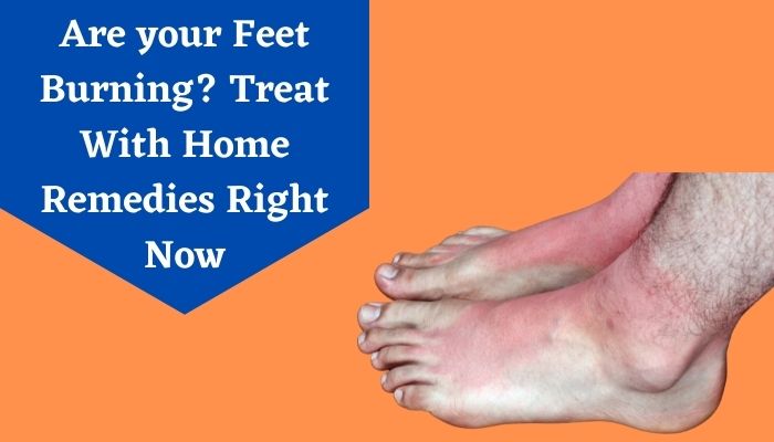 8 Best Home Remedies For Burning Feet You Must Try Once