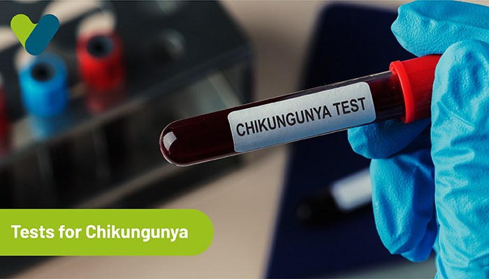 Tests for Chikungunya