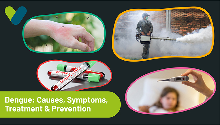 Dengue: Causes, Symptoms, Treatment & Prevention
