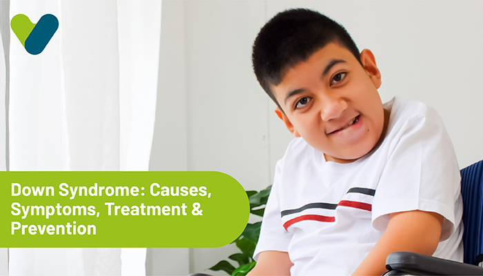 Down Syndrome: Causes, Symptoms, Treatment & Prevention