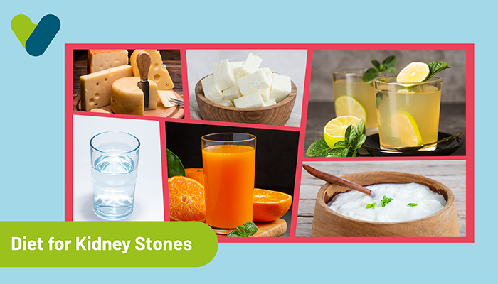Diet for Kidney Stones