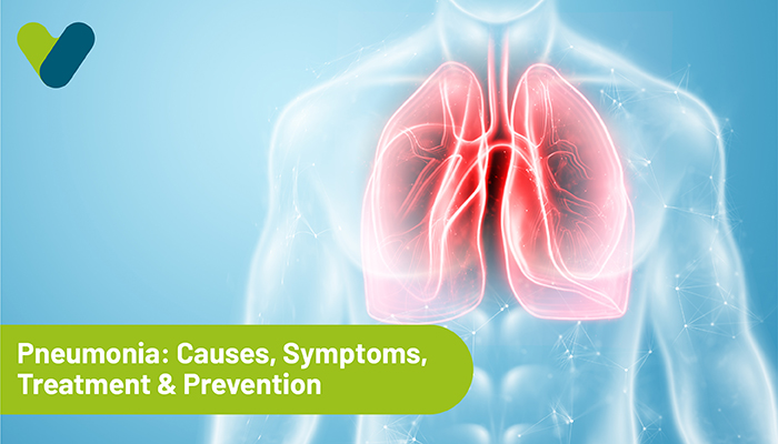 Pneumonia: Causes, Symptoms, Treatment & Prevention