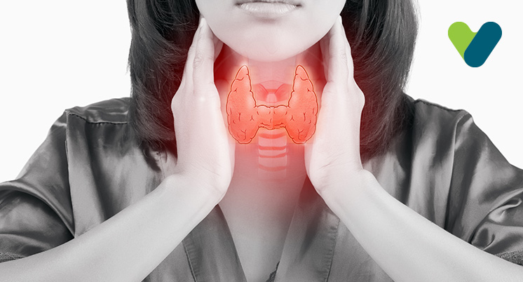 Causes of Thyroid Disease