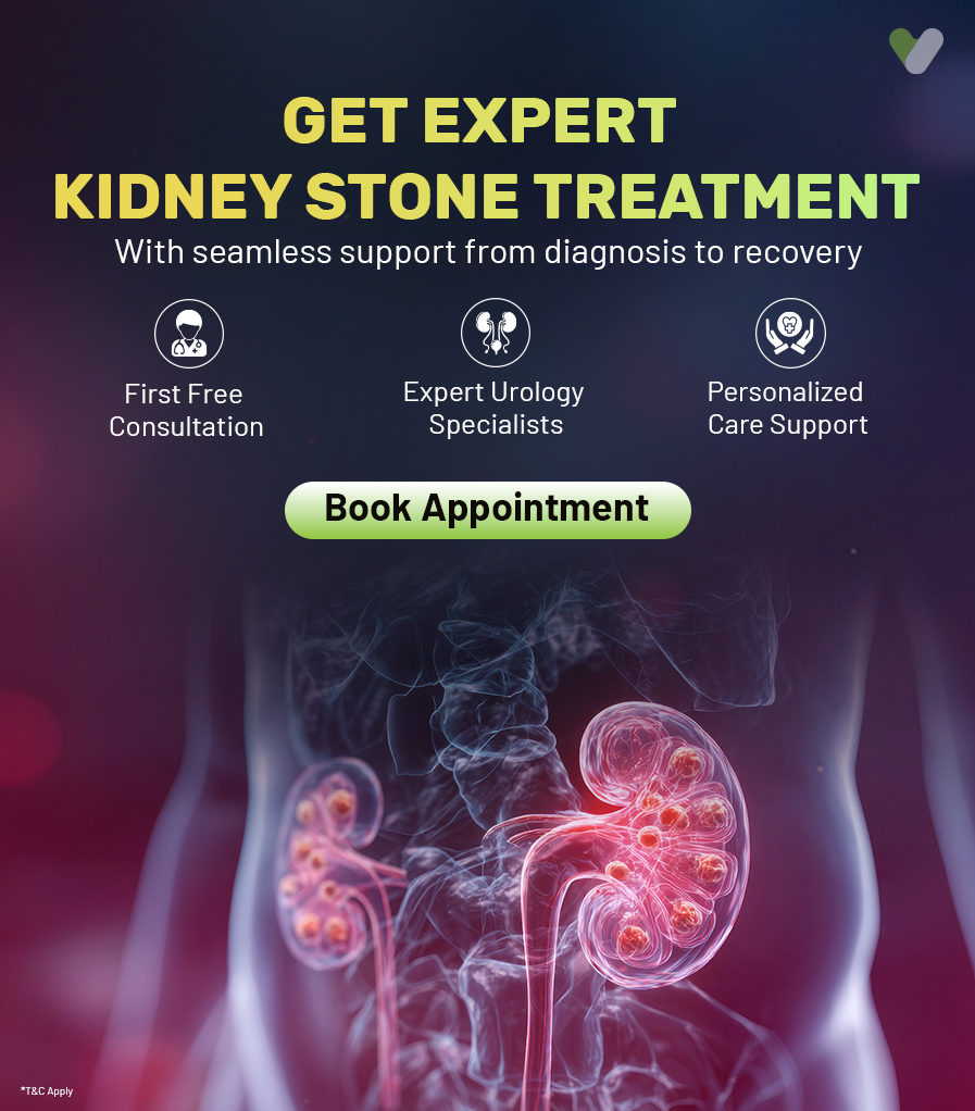 Kidney Stone Banner banner mobile